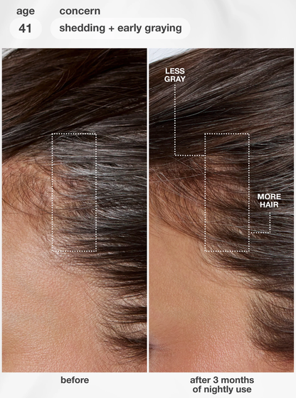 FutureIQ™ biomimetic hair longevity serum